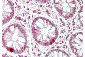 Rabbit Anti-CXXC1 antibody  Formalin Fixed Paraffin Embedded Tissue: Human Colon Primary antibody Concentration: 1:100 Secondary Antibody: Donkey anti-Rabbit-Cy3 Secondary Antibody Concentration: 1:200 Magnification: 20x Exposure Time: 0. (CXXC1 抗体  (Middle Region))