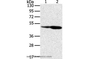 Western blot analysis of Hepg2 and hela cell, using SNX8 Polyclonal Antibody at dilution of 1:400 (SNX8 抗体)