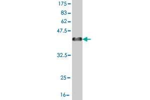 Western Blot detection against Immunogen (37. (EYA2 抗体  (AA 164-271))