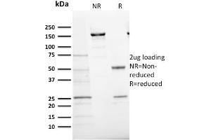 SDS-PAGE Analysis Purified Ki67 Mouse Monoclonal Antibody (MKI67/2466). (Ki-67 抗体  (AA 2293-2478))
