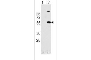 Western blot analysis of ALDH1A1 using rabbit polyclonal ALDH1A1 Antibody using 293 cell lysates (2 ug/lane) either nontransfected (Lane 1) or transiently transfected with the ALDH1A1 gene (Lane 2). (ALDH1A1 抗体  (AA 302-331))