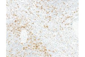 Immunohistochemistry (IHC) image for anti-CD5 (CD5) (AA 25-371) antibody (ABIN7449418) (Recombinant CD5 抗体  (AA 25-371))