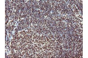 Image no. 4 for anti-Exosome Component 7 (EXOSC7) antibody (ABIN1498140)