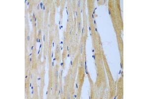 Immunohistochemistry of paraffin-embedded rat heart using MGAT3 antibody. (MGAT3 抗体  (AA 364-533))
