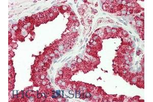 IHC-P analysis of Human Prostate Gland Tissue, with HE staining.