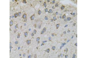 Immunohistochemistry of paraffin-embedded Mouse brain using DBI Polyclonal Antibody at dilution of 1:100 (40x lens). (Diazepam Binding Inhibitor 抗体)