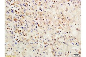 Formalin-fixed and paraffin embedded: rat brain tissue labeled with Anti-SOCS 1 Polyclonal Antibody , Unconjugated 1:200 followed by conjugation to the secondary antibody and DAB staining (SOCS1 抗体  (AA 121-211))