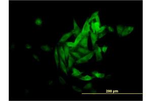 Immunofluorescence of monoclonal antibody to NQO1 on HepG2 cell.