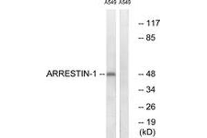 Western blot analysis of extracts from A549 cells, treated with Etoposide 25uM 60', using Arrestin 1 (Ab-412) Antibody. (SAG 抗体  (AA 369-418))