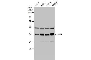 WB Image Various whole cell extracts (30 μg) were separated by 10% SDS-PAGE, and the membrane was blotted with RAP antibody [N1C3] , diluted at 1:1000. (LRPAP1 抗体  (Center))