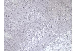 Immunohistochemistry (IHC) image for anti-Solute Carrier Family 18 (Vesicular Monoamine Transporter), Member 2 (SLC18A2) (C-Term) antibody (ABIN570915)