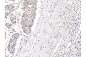 Immunohistochemistry (IHC) image for anti-Glypican 3 (GPC3) (AA 343-559) antibody (ABIN7432952)