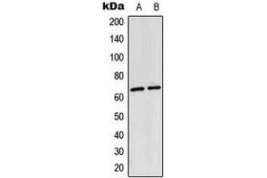 Western blot analysis of NF-kappaB p65 (AcK310) expression in HeLa (A), mouse lung (B) whole cell lysates. (NF-kB p65 抗体  (acLys310))