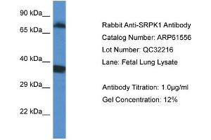 Western Blotting (WB) image for anti-SRSF Protein Kinase 1 (SRPK1) (C-Term) antibody (ABIN2788838) (SRPK1 抗体  (C-Term))