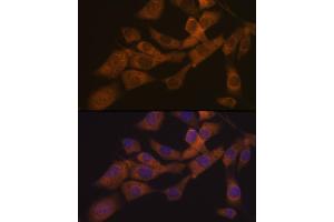 Immunofluorescence analysis of NIH-3T3 cells using KIF3A Rabbit mAb (ABIN7268132) at dilution of 1:100 (40x lens). (KIF3A 抗体)