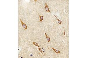 Immunohistochemical analysis of raffin-embedded H. (PAFAH1B1 抗体  (N-Term))