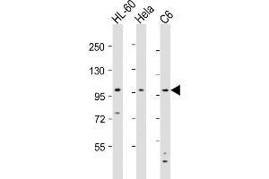 All lanes : Anti-NCSTN Antibody (N-Term) at 1:8000 dilution Lane 1: HL-60 whole cell lysates Lane 2: Hela whole cell lysates Lane 3: C6 whole cell lysates Lysates/proteins at 20 μg per lane. (Nicastrin 抗体  (AA 99-133))