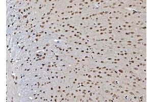 IHC analysis of THAP11 using anti-THAP11 antibody (ABIN7599230). (THAP11 抗体  (AA 1-294))