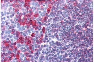 Human Tonsil: Formalin-Fixed, Paraffin-Embedded (FFPE) (CD79a 抗体  (AA 202-216))