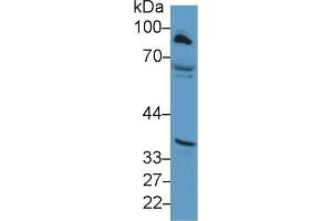 Western Blotting (WB) image for anti-Carnitine Palmitoyltransferase 1A (Liver) (CPT1A) (AA 191-353) antibody (ABIN7436006)
