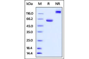 Human BTN1A1, Fc Tag on SDS-PAGE under reducing (R) and no-reducing (NR) conditions. (BTN1A1 Protein (AA 27-242) (Fc Tag))