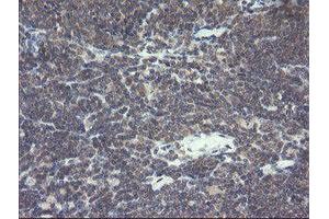 Image no. 5 for anti-Prefoldin Subunit 3 (PFDN3) antibody (ABIN1501702)