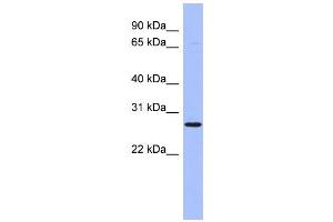 WB Suggested Anti-HOXA6 Antibody Titration:  0. (HOXA6 抗体  (Middle Region))