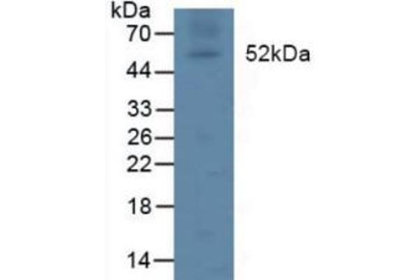 Lipoprotein Lipase 抗体  (AA 55-316)