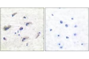 Immunohistochemistry analysis of paraffin-embedded human brain, using Tau (Phospho-Ser356) Antibody. (tau 抗体  (pSer673))