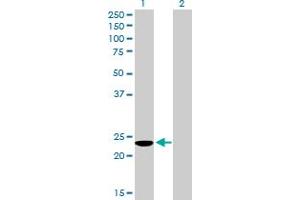 Western Blot analysis of COMMD3 expression in transfected 293T cell line by COMMD3 MaxPab polyclonal antibody. (COMMD3 抗体  (AA 1-195))