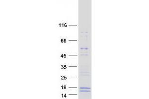 Validation with Western Blot (GALP Protein (Transcript Variant 1) (Myc-DYKDDDDK Tag))