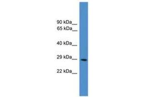 Image no. 1 for anti-Protein Kinase, CAMP Dependent, Catalytic, beta (PRKACB) (N-Term) antibody (ABIN6745502)