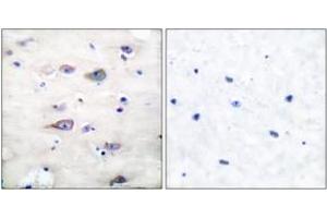 Immunohistochemistry (IHC) image for anti-Glutamate Receptor, Ionotropic, AMPA 2 (GRIA2) (AA 834-883), (pSer880) antibody (ABIN1531853)