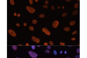 Immunofluorescence analysis of U-2 OS cells using HDGF Polyclonal Antibody at dilution of 1:100. (HDGF 抗体)