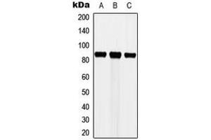 Western blot analysis of Cortactin expression in MCF7 (A), HeLa (B), NIH3T3 (C) whole cell lysates. (Cortactin 抗体  (Center))