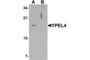 Western blot analysis of YPEL4 in SW480 cell lysate with YPEL4 antibody at 1 ug/mL in (A) the absence and (B) the presence of blocking peptide. (YPEL4 抗体  (N-Term))