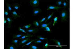 Immunofluorescence of monoclonal antibody to HN1L on HeLa cell. (HN1L 抗体  (AA 1-190))