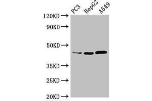 Western Blot Positive WB detected in: PC-3 whole cell lysate, HepG2 whole cell lysate, A549 whole cell lysate All lanes: DNMT3L antibody at 3. (DNMT3L 抗体  (AA 1-234))