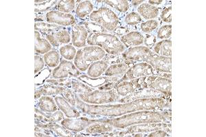 Immunohistochemistry of paraffin-embedded mouse kidney using SNRPD1 Rabbit pAb (ABIN7270363) at dilution of 1:50 (40x lens). (SNRPD1 抗体  (AA 1-100))