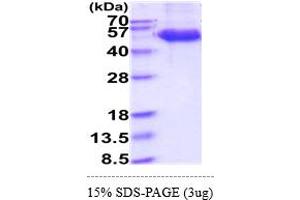SDS-PAGE (SDS) image for Killer Cell Lectin-Like Receptor Subfamily K, Member 1 (KLRK1) (AA 73-216) protein (hIgG-His-tag) (ABIN7281286) (KLRK1 Protein (AA 73-216) (hIgG-His-tag))
