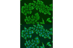 Immunofluorescence analysis of U2OS cells using HAUS8 antibody. (NYS48/HAUS8 抗体  (AA 166-410))