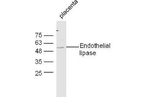 Mouse placenta lysates probed with Anti-Endothelial lipase Polyclonal Antibody, Unconjugated  at 1:5000 90min in 37˚C. (LIPG 抗体  (AA 301-400))