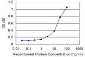 Detection limit for recombinant GST tagged DBF4B is 1 ng/ml as a capture antibody. (DBF4B/DRF1 抗体  (AA 201-299))