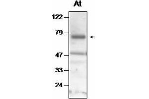 Western blot analysis of Arabidopsis thaliana thylakoid proteins with anti-Deg2