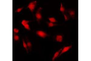 ABIN6269222 staining NIH-3T3 by IF/ICC. (Merlin 抗体  (C-Term))