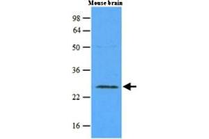 Western blot analysis of mouse brain extracts (45 ug) were resolved by SDS - PAGE , transferred to NC membrane and probed with RAB5A monoclonal antibody , clone 3A4 (1 : 500) . (RAB5 抗体)