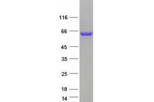 Western Blotting (WB) image for RAD23 Homolog B (RAD23B) protein (Myc-DYKDDDDK Tag) (ABIN2730408)
