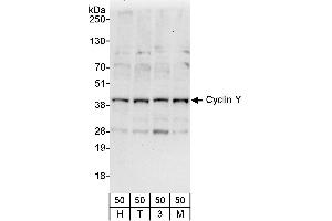 Western Blotting (WB) image for anti-Cyclin Y (CCNY) (AA 291-341) antibody (ABIN7453262)