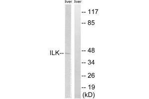 Western blot analysis of extracts from rat liver cells, using ILK (epitope around residue 246) antibody. (ILK 抗体  (Ser246))