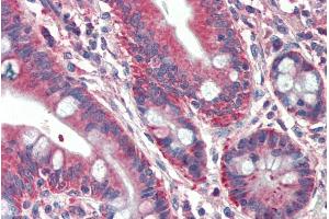 ABIN571280 (5µg/ml) staining of paraffin embedded Human Small Intestine. (RUFY1 抗体  (Internal Region))